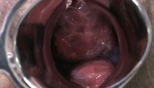 Pornobild Die schwangere Japanerin wird untersucht und saugt den Lutscher des Arztes